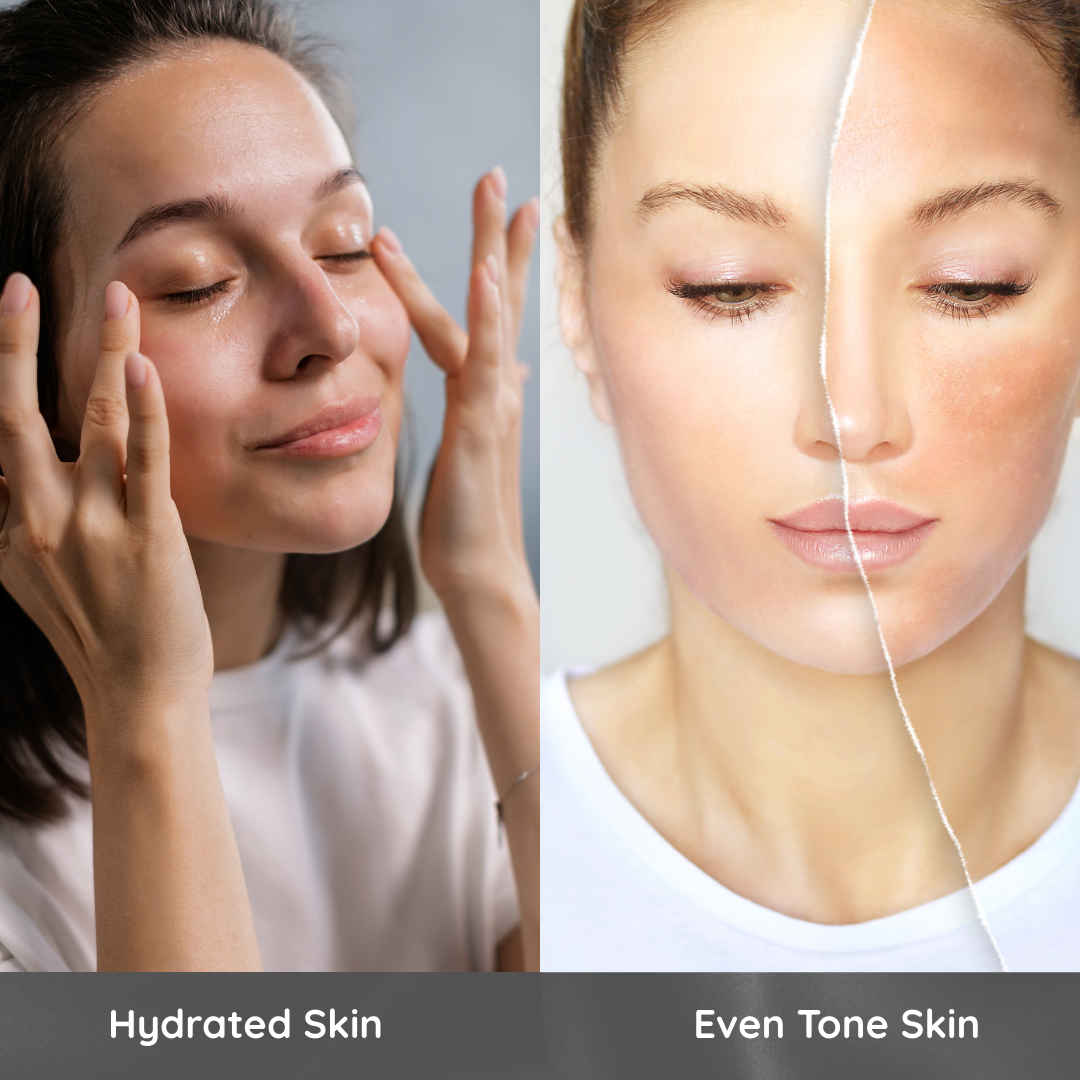 Skinluent Kojic Acid Soap for Even tone skin